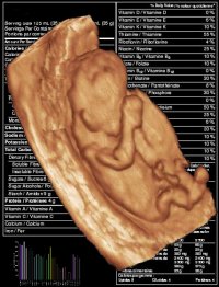 babyscan.jpg